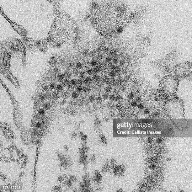 thin section transmission electron micrograph (tem) showing numerous, spheroid-shaped enterovirus-d68 (ev-d68) virions. ev-d68 can cause mild to severe respiratory illness - enterovirus stock pictures, royalty-free photos & images