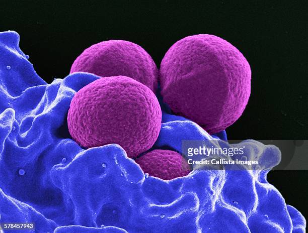 colorized sem of four spherical methicillin-resistant staphylococcus aureus (mrsa) bacteria (purple) in the process of being phagocytized by a human neutrophil white blood cell (blue) - stafylokokken stockfoto's en -beelden