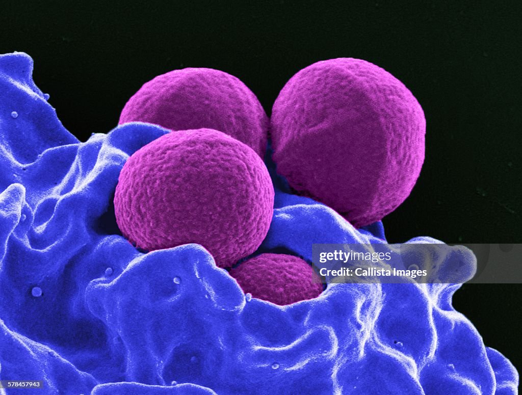 Colorized SEM of four spherical methicillin-resistant Staphylococcus aureus (MRSA) bacteria (purple) in the process of being phagocytized by a human neutrophil white blood cell (blue)