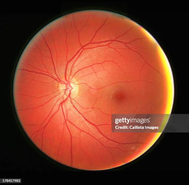 fundus photograph of the left eye, showing the retina, macula, fovea and related structures - retina stock pictures, royalty-free photos & images