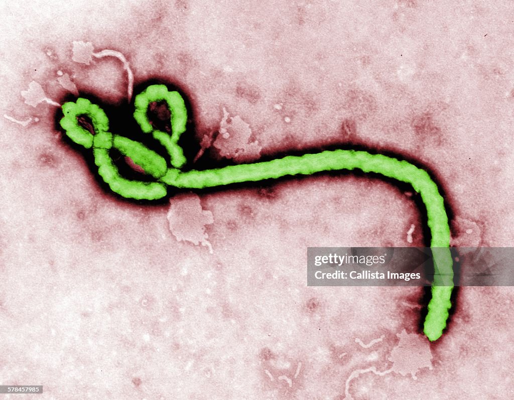 Transmission electron micrograph (TEM) of an Ebola virus virion