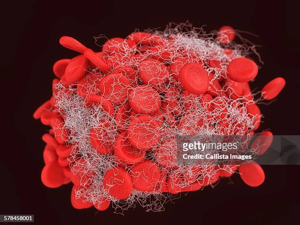 illustration of a blood clot showing a clump of red blood cells intertwined in a fibrin mesh - fibrin stock illustrations