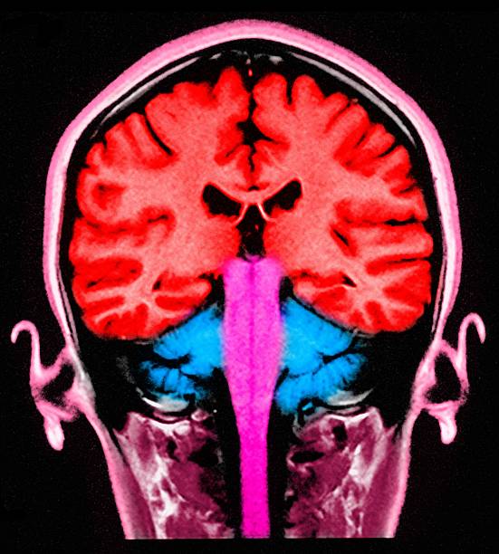 Red Brain Scan 8,865 Color Brain Scan Stock Photos, High-Res Pictures, and Images ...