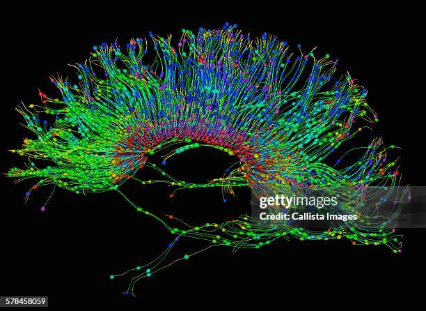 17 Diffusion Tensor Mri Stock Photos, High-Res Pictures, and Images ...