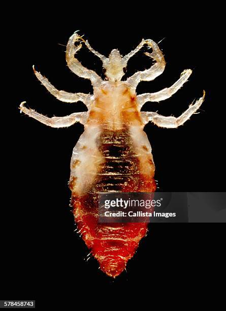 dorsal view of a male body louse, pediculus humanus var. corporis. sensorial setae, (hairs) cover the louses body.the dark mass inside the abdomen is a previously ingested blood meal - body louse stockfoto's en -beelden