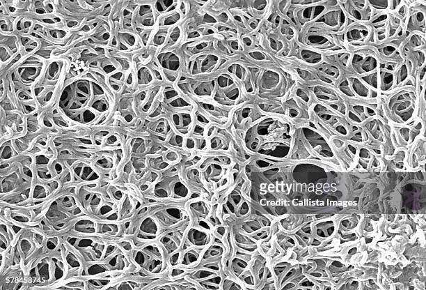 scanning electron micrograph of gram negative, anaerobic, borrelia burgdorferi bacteria, which had been derived from a pure culture. this pathogenic organism is responsible for causing lyme disease - virus organism foto e immagini stock