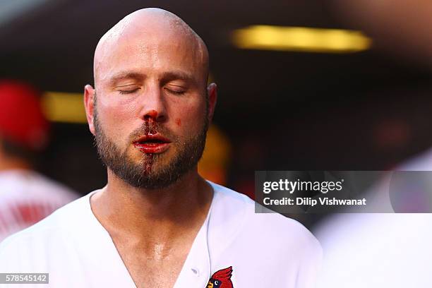 Matt Holliday of the St. Louis Cardinals leaves the game after being hit in the nose by a pitch against San Diego Padres in the sixth inning at Busch...