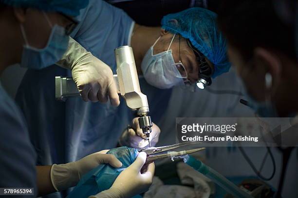 Medical staff fixes the new titanium upper beak on a red-crowned crane named Li Li in an animal hospital on July 10, 2016 in Guangzhou, China. The...