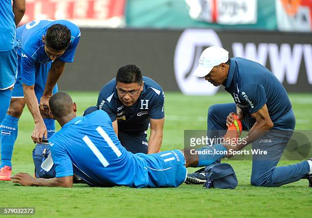 Honduras Forward Jerry Bengtson lays on the pitch as staff members look at his foot during an international friendly world cup warm up soccer match...