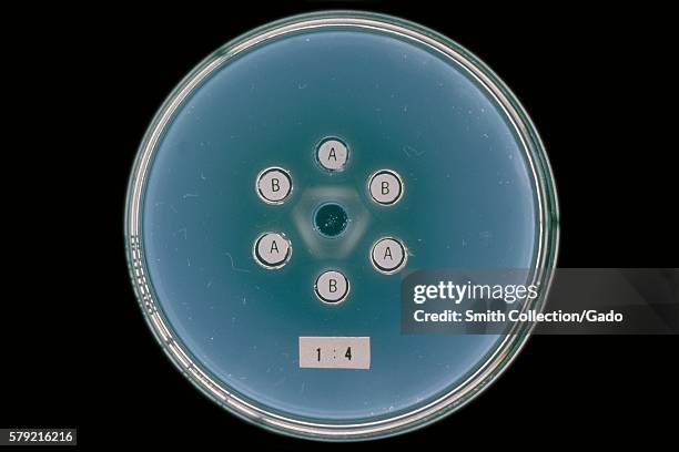 Agar gel reactions of Actinomyces sp. Strains X-407 and X-573, with homologous antibodies A and B, 1964. Actinomyces sp. Normally found in the oral...