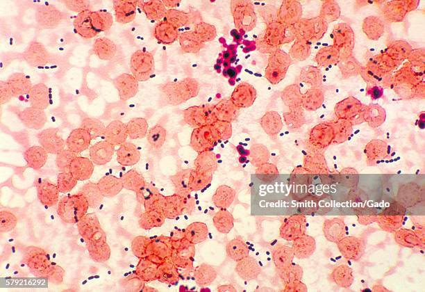 Enterococcus Photos and Premium High Res Pictures - Getty Images