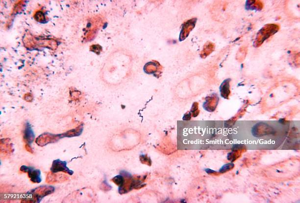 Photomicrograph revealing Treponema carateum bacteria obtained from a chimpanzee using Krajain's stain, 1970. Pinta is caused by Treponema carateum....
