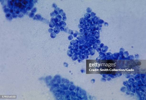 Photomicrograph of the fungus Candida albicans, 1963. Candida albicans lives in numerous parts of the body as normal flora. However, when an...