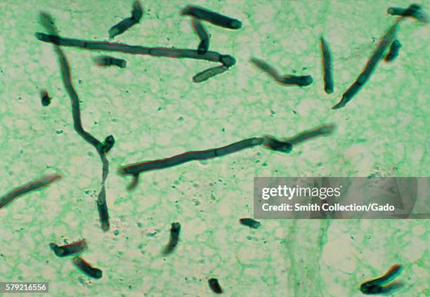 Micrograph of a pigeon brain using methenamine silver stain, revealing the presence of the fungus Ochroconis gallopavum, formerly Dactylaria...