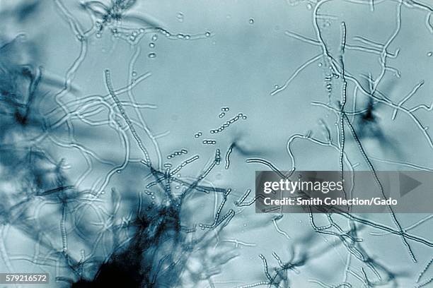 This is a slide culture of a Streptomyces sp. Grown on tap water agar, 1972. Branching filaments, abundant aerial mycelia, and long chains of small...