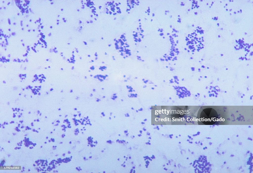 Francisella Tularensis