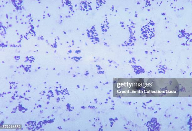 This is a photomicrograph of Francisella tularensis bacteria using a methylene blue stain, 1972. The bacterium F. Tularensis is considered to be a...