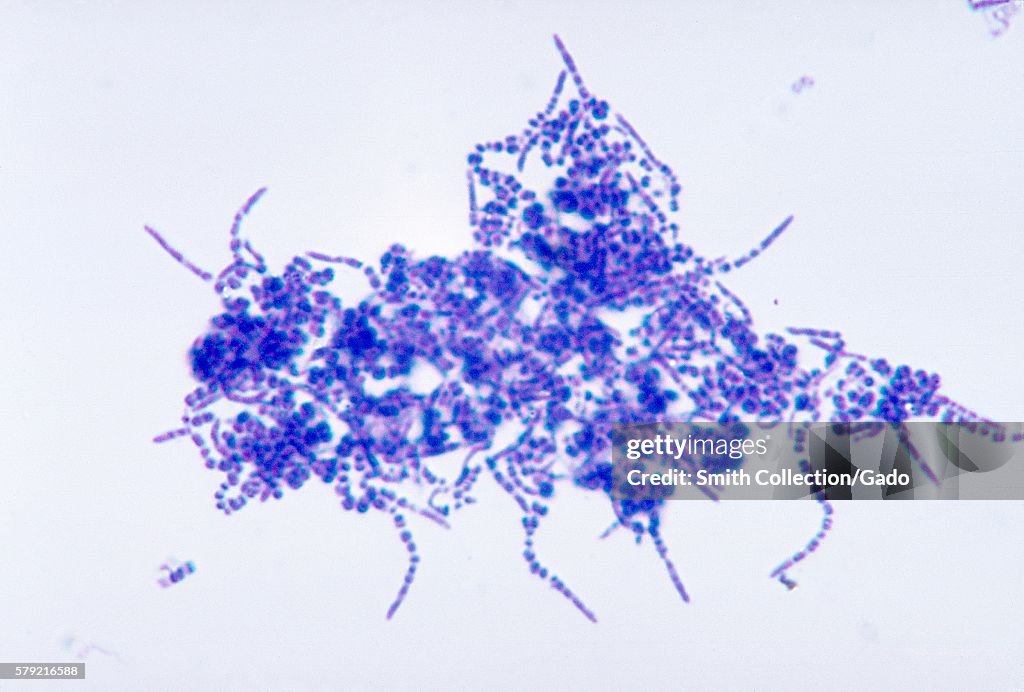 Dermatophilus Congolensis