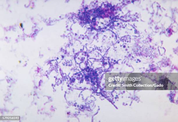 This is a photomicrograph of Dermatophilus congolensis bacteria using a Giemsa stain, 1972. Dermatophilus congolensis is a gram-positive,...