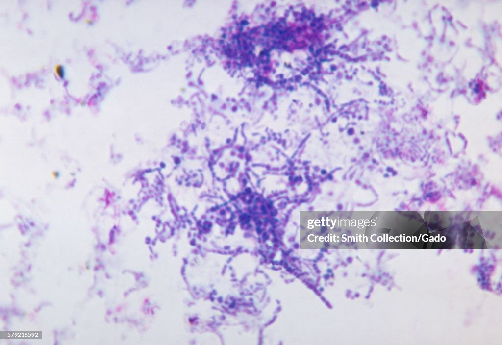 Dermatophilus Congolensis