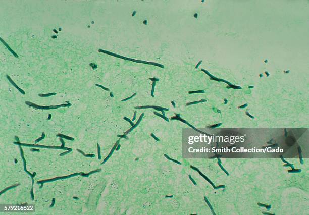 Micrograph of a pigeon brain using methenamine silver stain, revealing the presence of the fungus Ochroconis gallopavum, formerly Dactylaria...