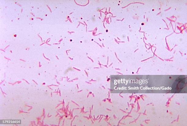 This photomicrograph shows the bacterium Fusobacterium russii cultured in a thioglycollate medium for 48 hours, 1972. F. Russii is a normal...