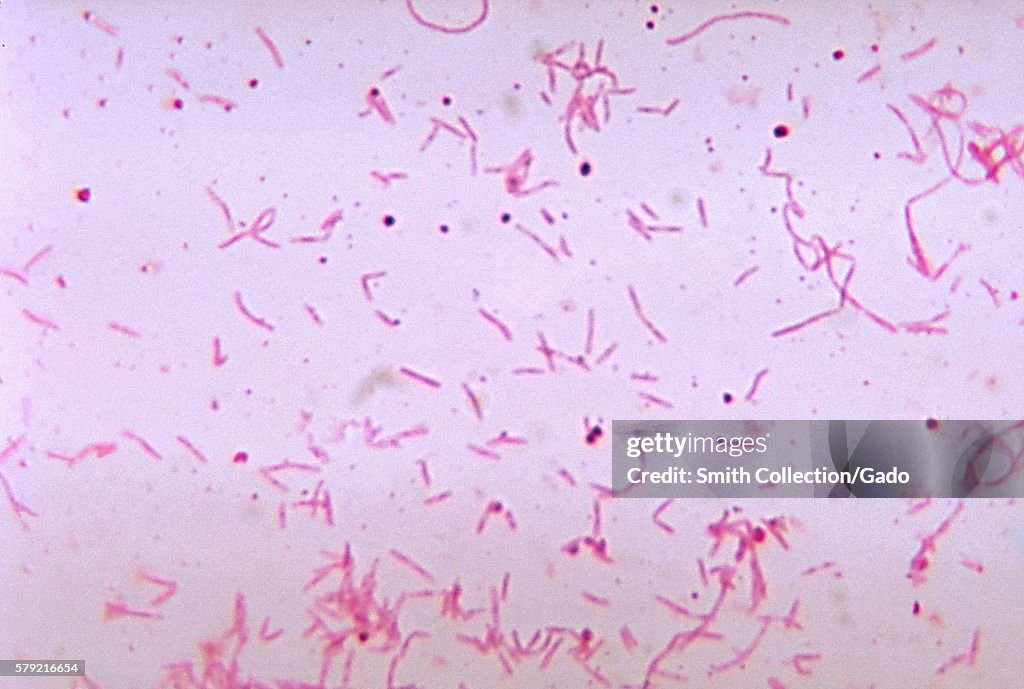 Fusobacterium Russii