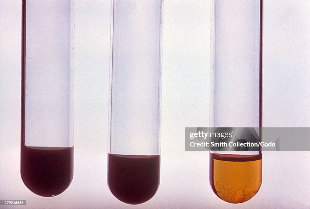 Nocardia Asteroids