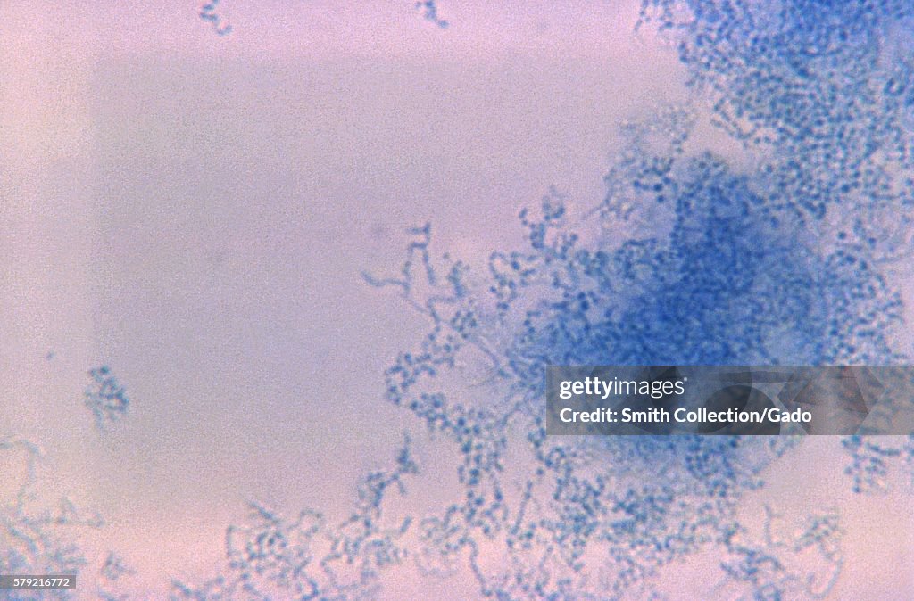 Nocardia Asteroides