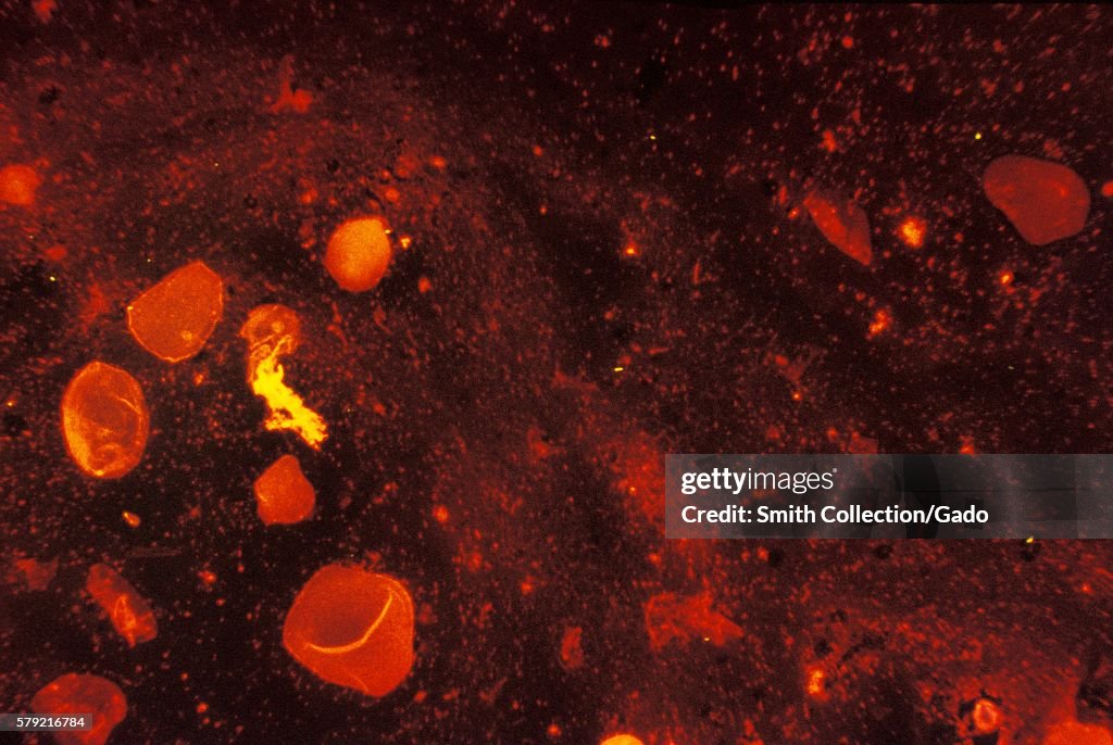 Mycobacterium Tuberculosis