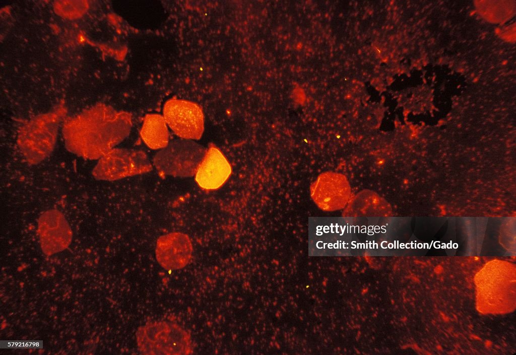 Mycobacterium Tuberculosis