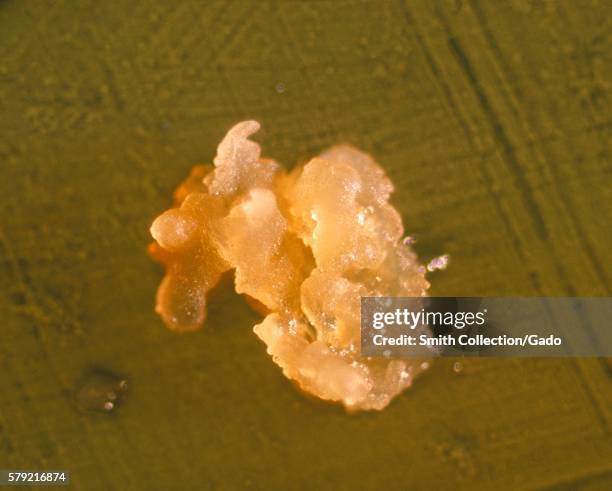 Agar plate culture of Actinomyces sp. Strain A-13-R, at 10 days, 1963. Actinomyces sp. Normally found in the oral cavity is an opportunistic pathogen...