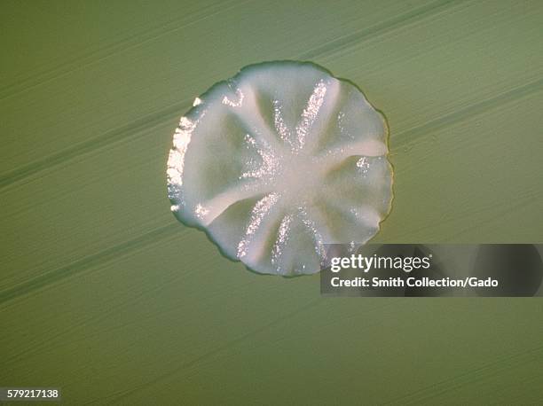 Plate culture of Actinomyces sp. A Gram positive opportunistic pathogen that is normally found in the oral cavity, 1963. Actinomyces spp. Are usually...