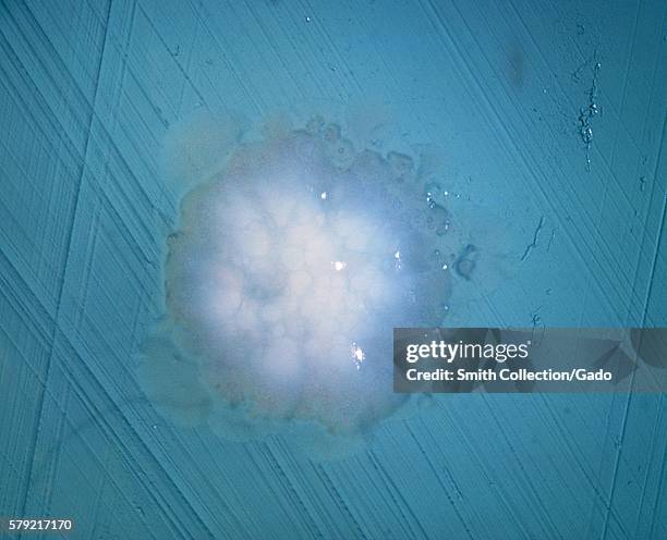 Agar plate culture of Actinomyces sp. Strain X-407, at 7 days, incubated anaerobically, 1963. Actinomyces sp. Normally found in the oral cavity is an...