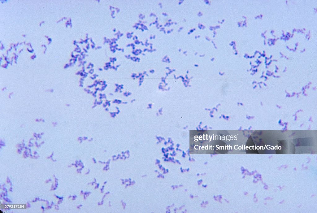 Propionibacterium Acnes