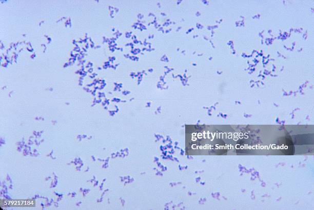 This micrograph depicts the gram-positive bacterium Propionibacterium acnes grown in blood agar for 48 hours, 1972. Propionibacterium acnes is a very...