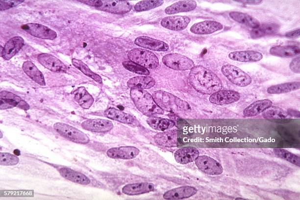 This photomicrograph reveals the intranuclear inclusions produced by varicella virus grown in a tissue culture, Magnified 500X, 1964. In a laboratory...