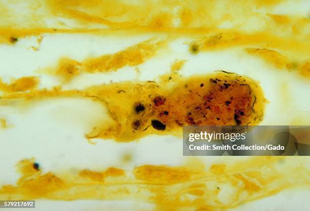 Photomicrograph of kidney tissue, using a silver staining technique, revealing the presence of Leptospira bacteria, 1964. Humans become infected by...