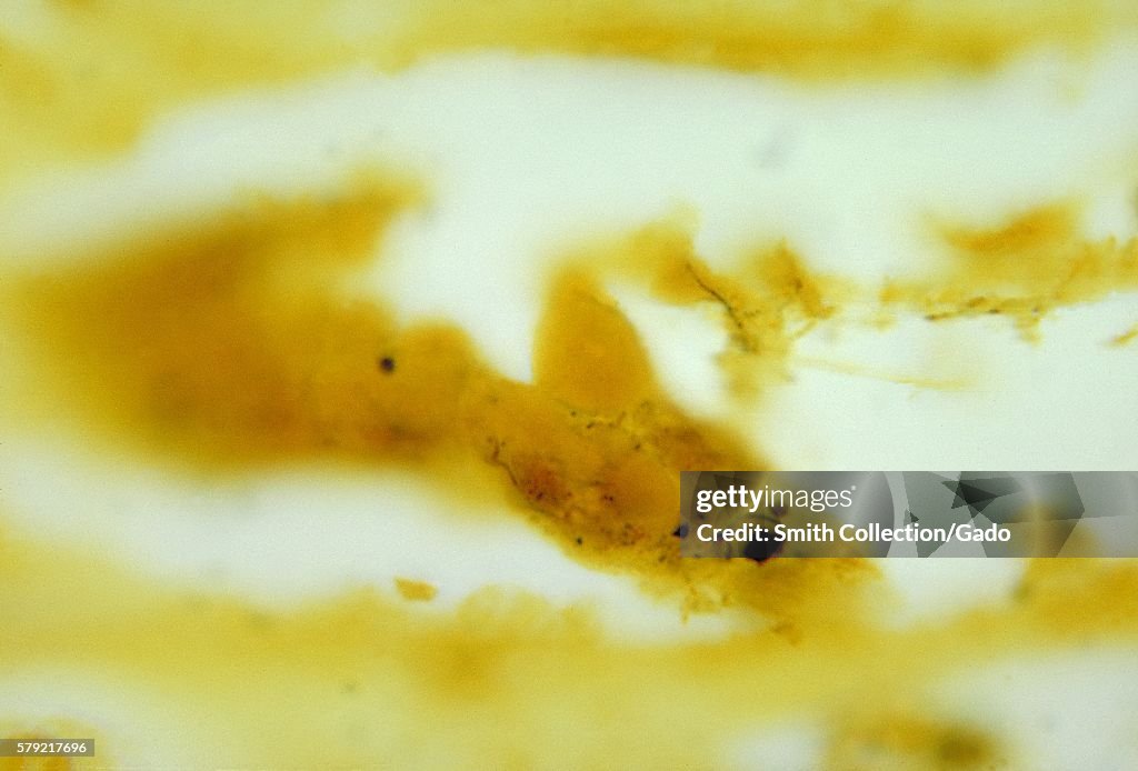 Leptospira