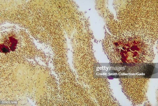 Photomicrograph of testicular tissue revealing histopathologic changes due to actinomycosis, using Brown and Brenn Gram-stain, 1964. Actinomyces spp....