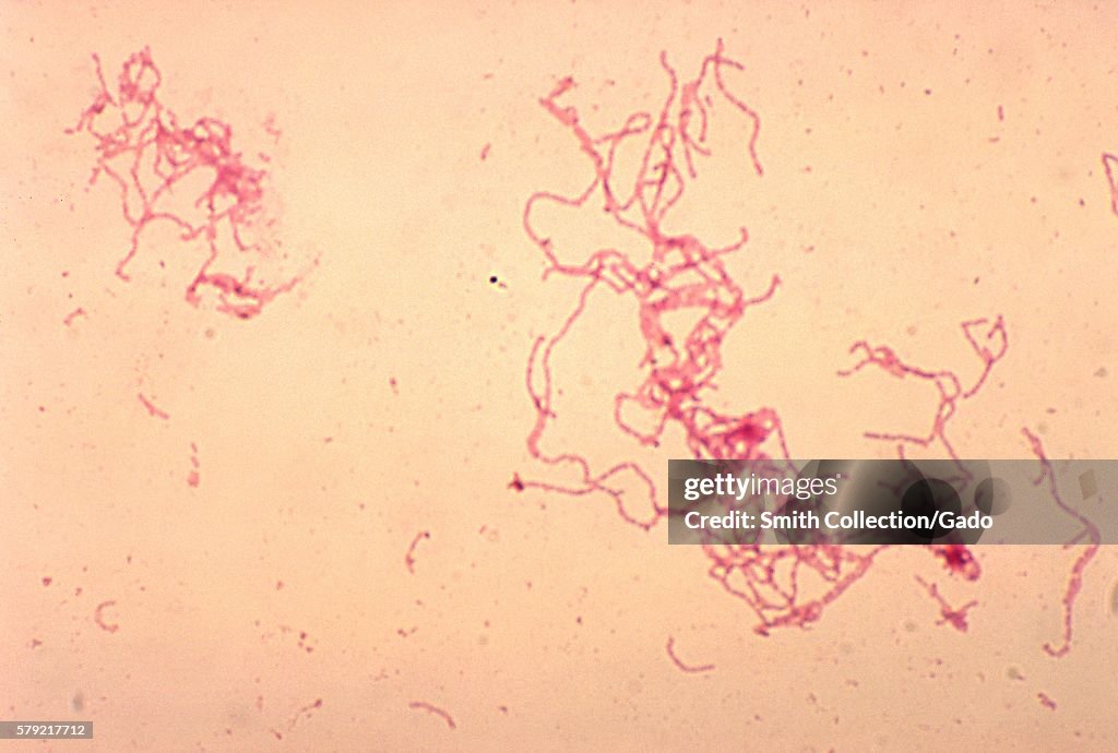 Haemophilus Ducreyi