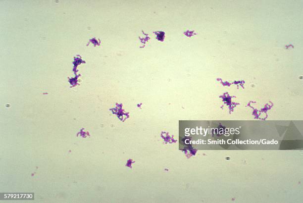 This micrograph depicts a number of Peptostreptococcus sp. Bacteria that had been grown in Schaedler's broth, and processed using Gram-stain...