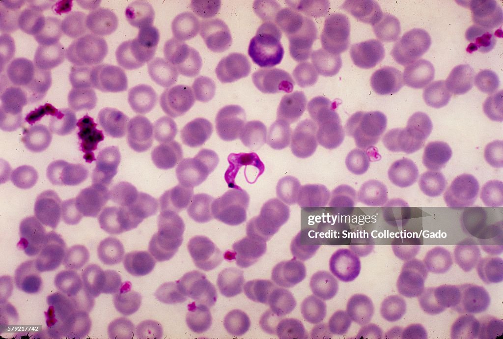 Trypanosoma Cruzi