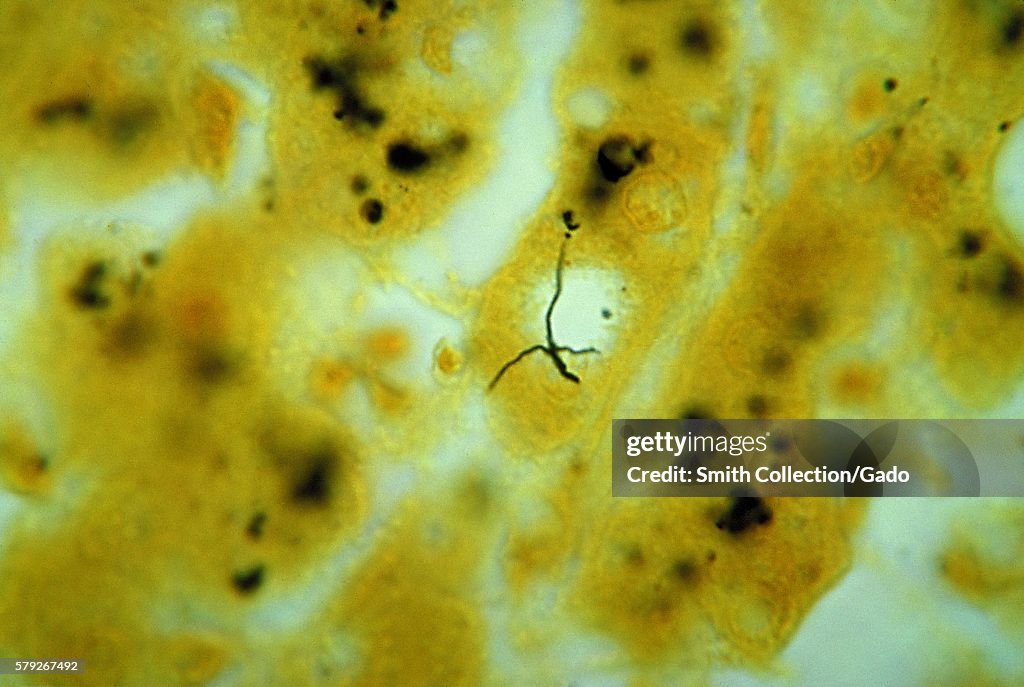 Leptospira