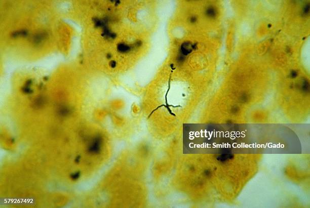 Photomicrograph of liver tissue revealing the presence of Leptospira bacteria, 1964. Humans become infected by swallowing water contaminated by...