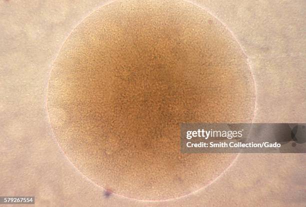 Diplococcus Microscope 118 Diplococcus Stock Photos, High-Res Pictures, and Images - Getty Images
