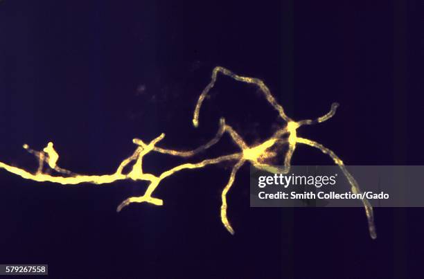 Photomicrograph of Actinomyces israelii taken from a brain abscess, and stained using an FA stain technique, 1969. Image courtesy CDC/Dr. Lucille...