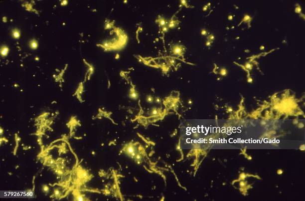 Photomicrograph of Actinomyces naeslundii using Direct FA staining technique, 1969. When growing as filaments, these Gram-positive rods are often...