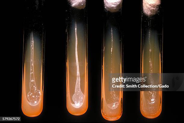 These slant cultures growing Actinomyces viscosus, reveal the oxygen requirements of this bacterium, 1971. Each culture represents the following...