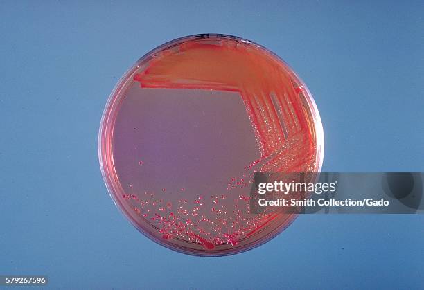 This is a MacConkey agar plate culture of Enterobacter sakazakii after 24 hours of growth at 36 C, 1978. Enterobacter sakazakii, a Gram-negative,...